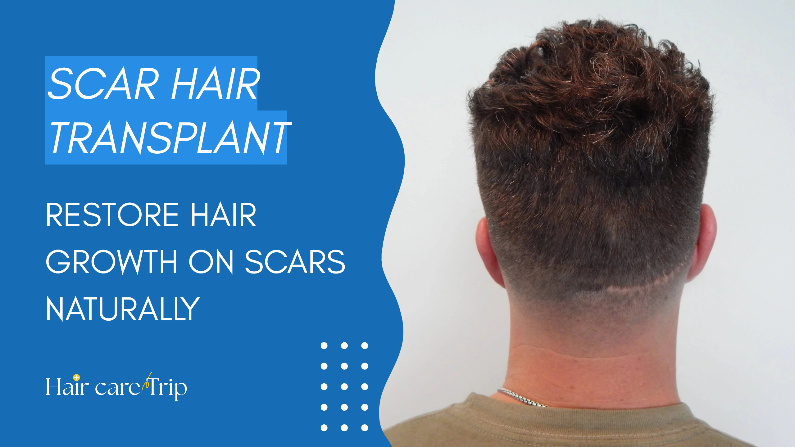 hair-care-trip-scar-hair-transplant-1