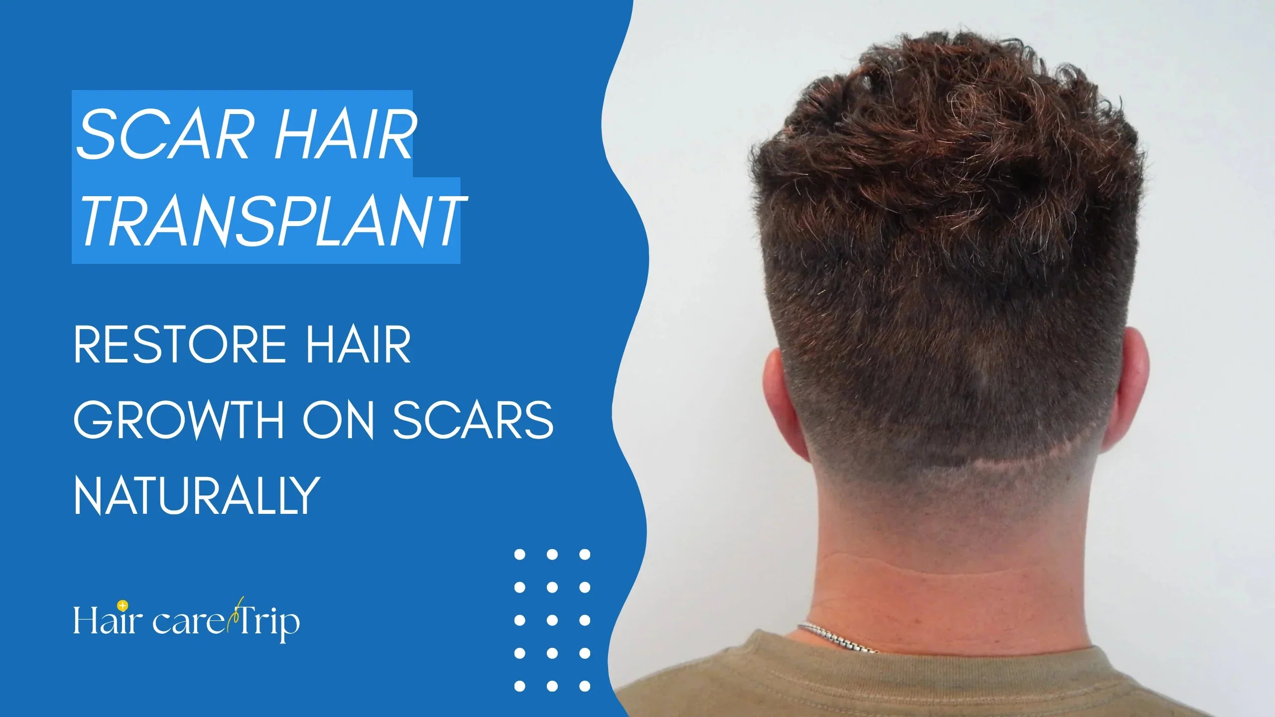 Scar Hair Transplant: Restore Hair Growth on Scars Naturally
