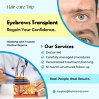 Eyebrow Transplant (Grafts)