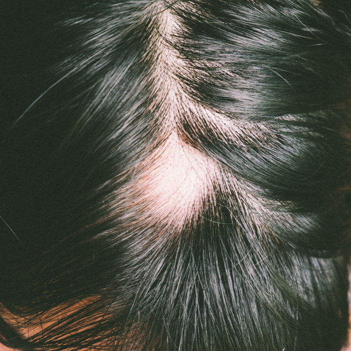 Scar Hair Restoration Deposit
