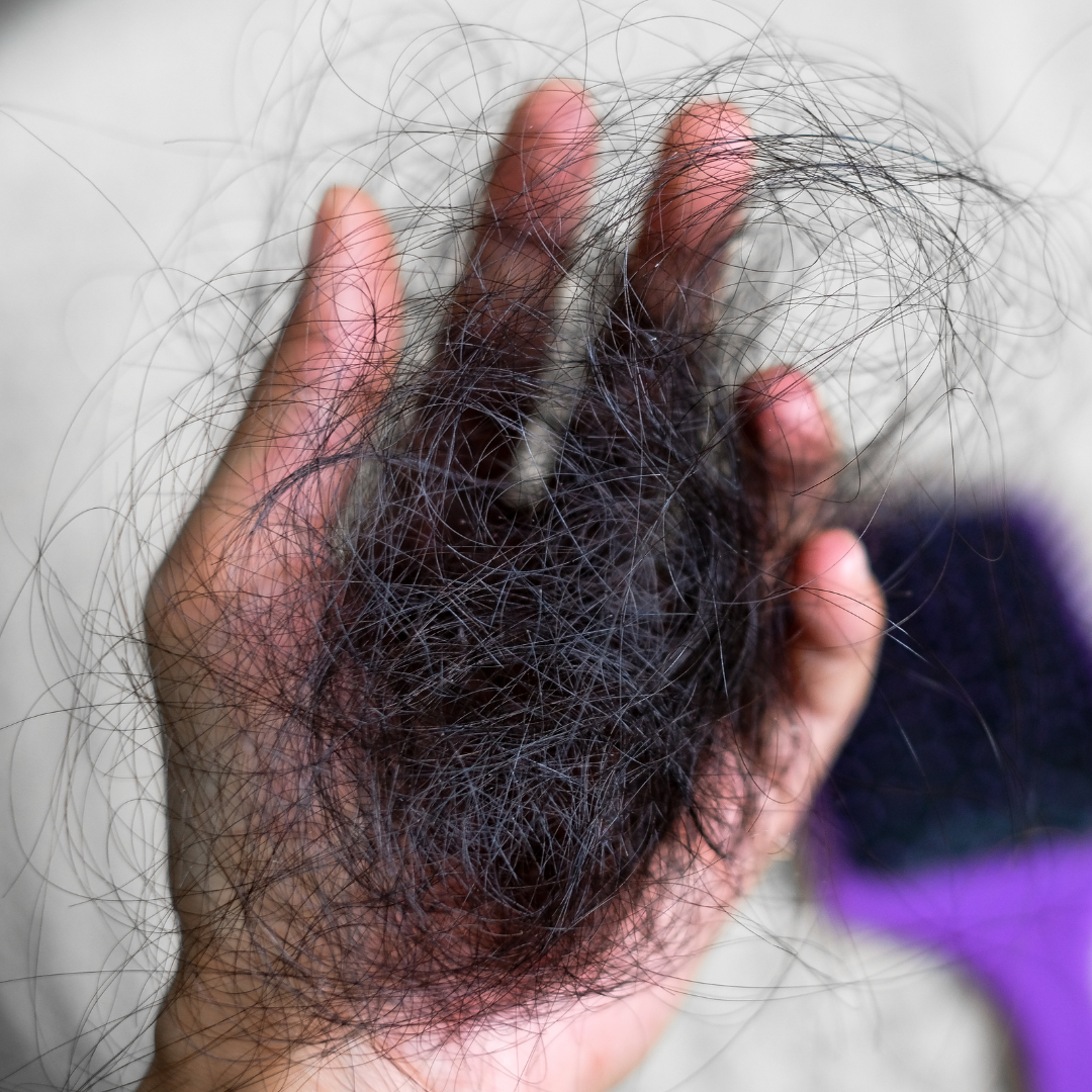 PRP Hair Treatment Service